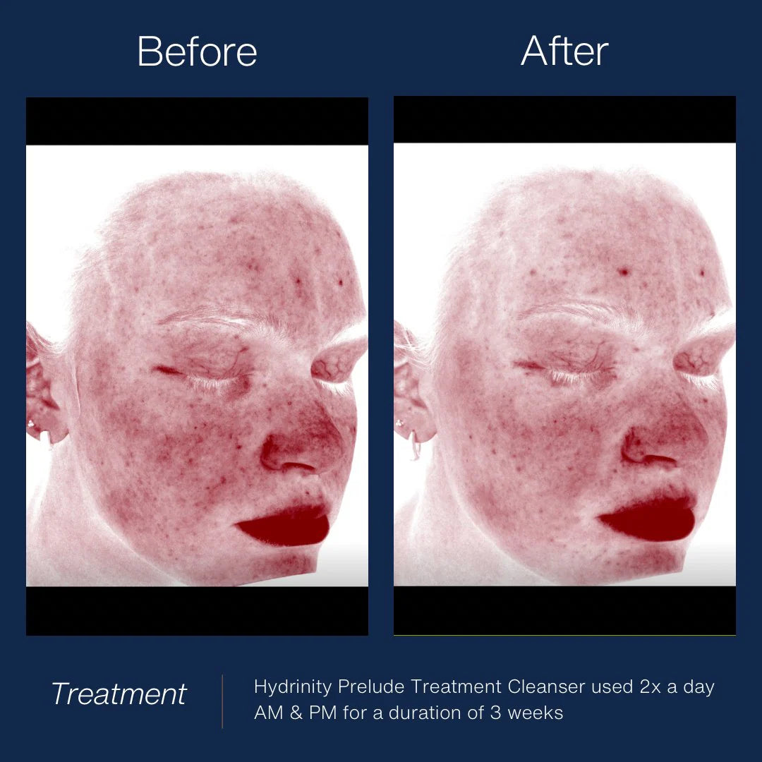 Prelude Facial Cleanser image 1