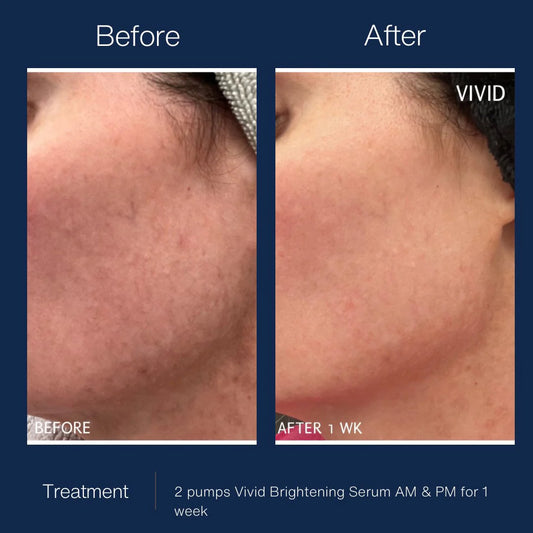 Vivid Brightening Serum image 1