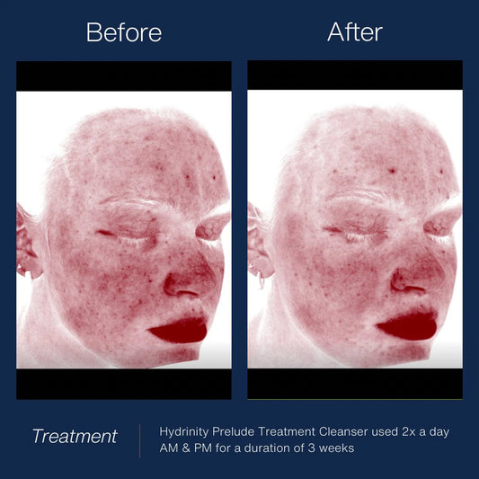 Prelude Facial Cleanser image 1