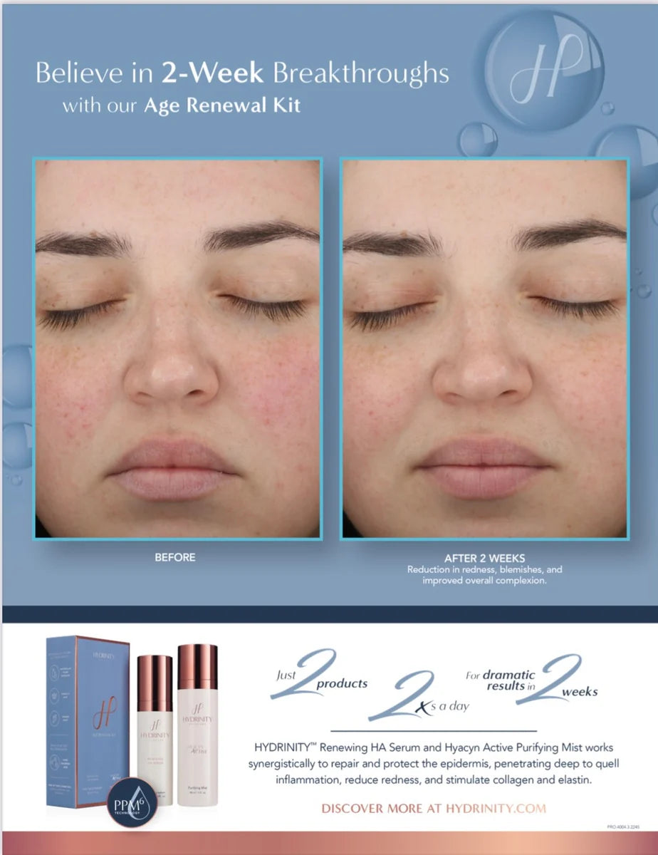 Age Renewal Kit image 1