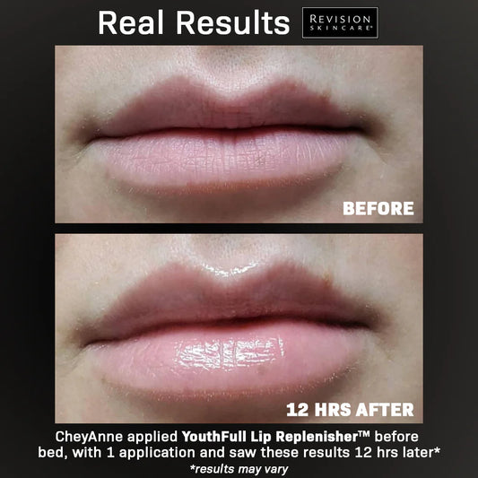 Revision SkinCare Youthful Lip Replenisher image 1