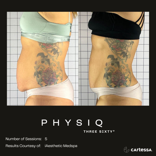 Physiq 360- 5 sessions