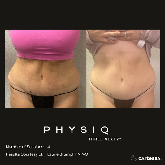 Physiq 360- 5 sessions
